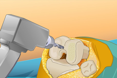 mzl.zuixqkxl.320x480-75