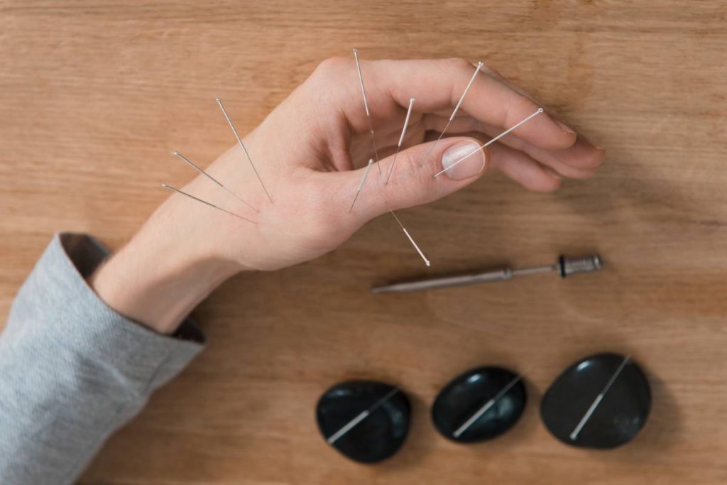 Man using acupuncture treatment for pain relief. Chinese alternative medicine